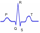 ecg